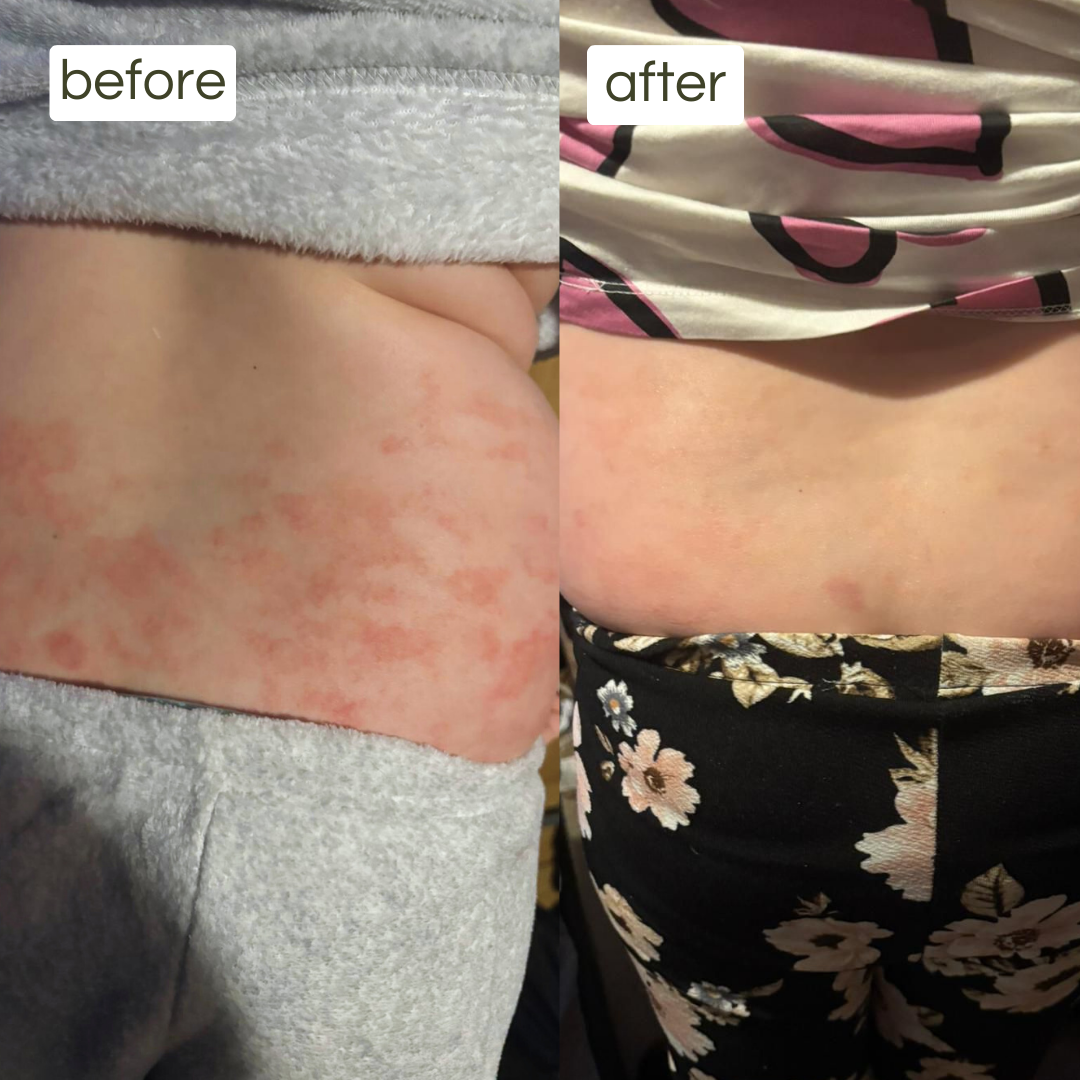 ultra sensitive balm