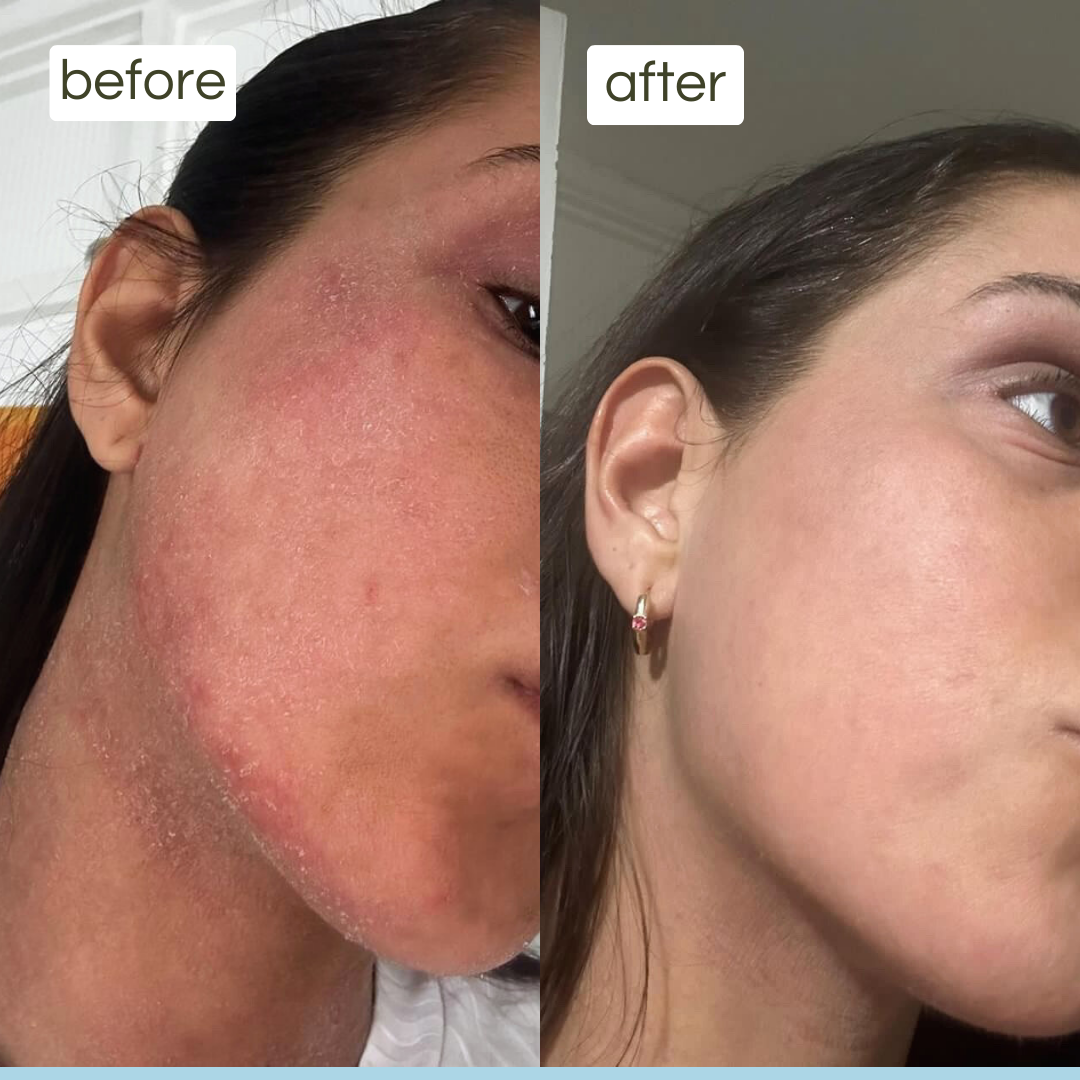 ultra sensitive balm