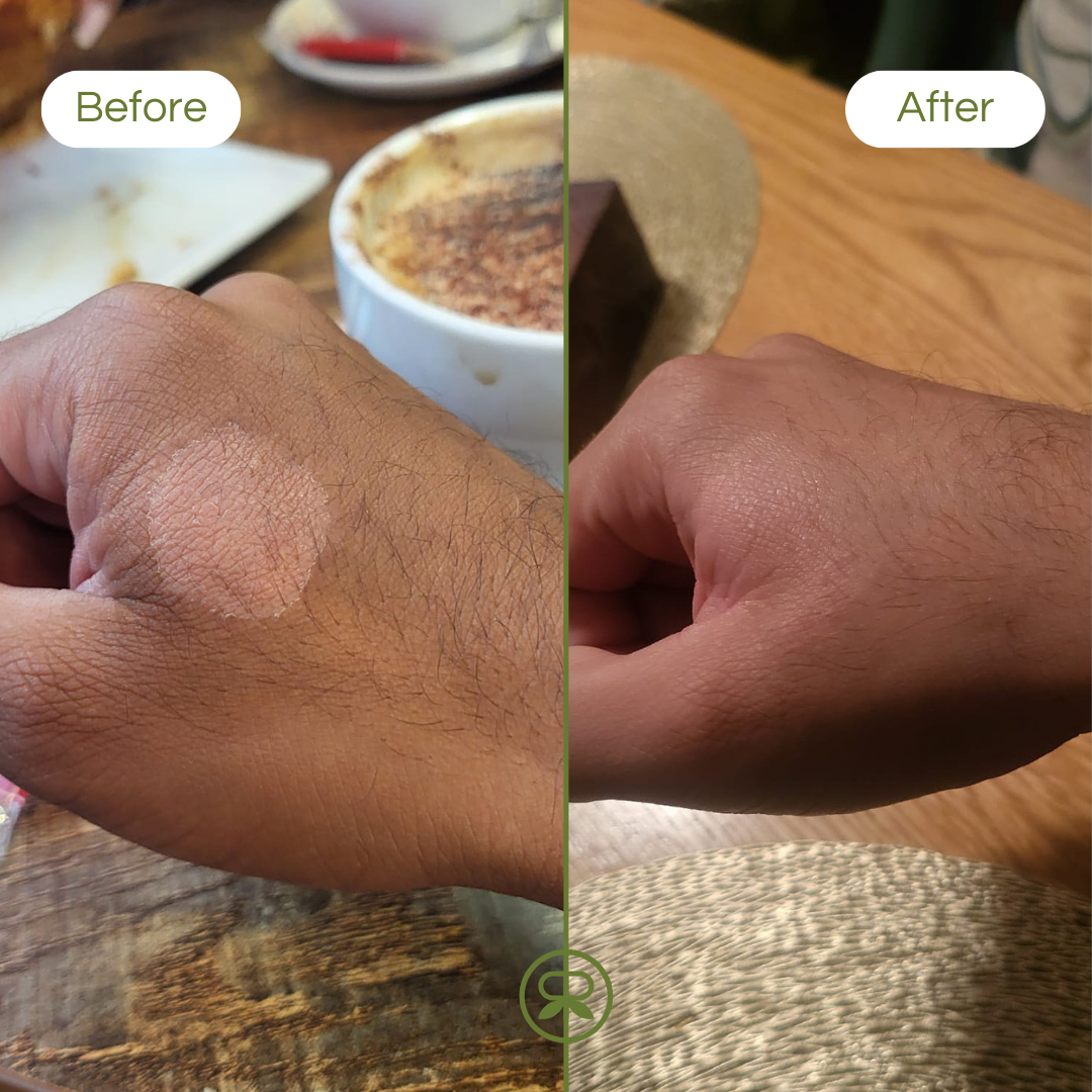 ultra sensitive balm