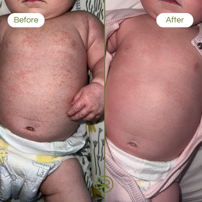 ultra sensitive balm