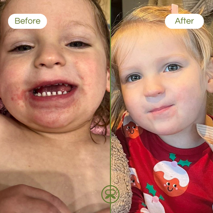 ultra sensitive balm