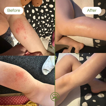 ultra sensitive balm