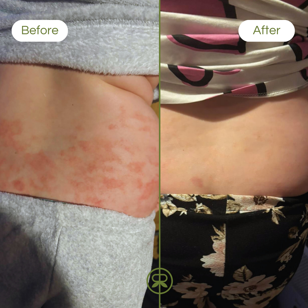 ultra sensitive balm