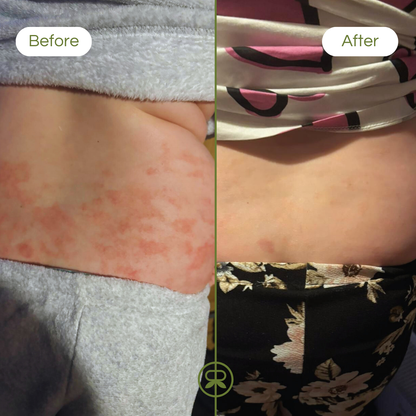 ultra sensitive balm