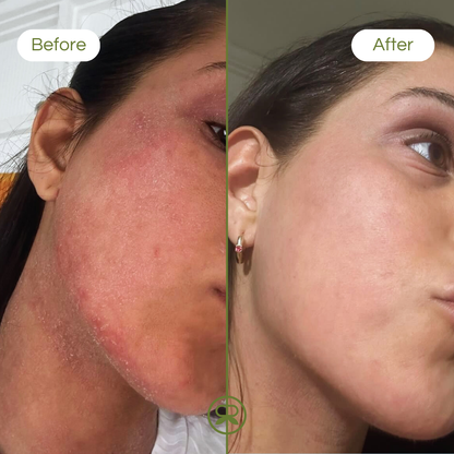 ultra sensitive balm