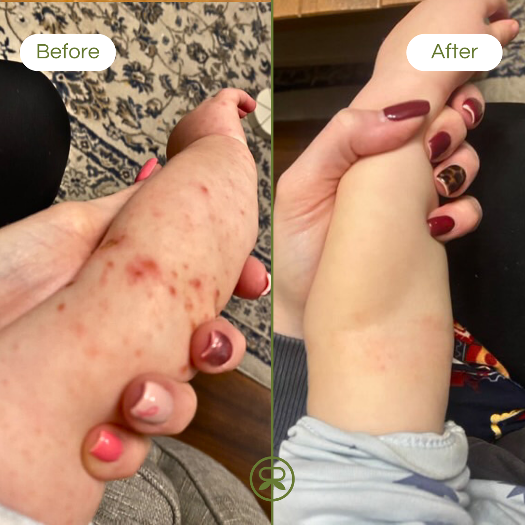 ultra sensitive balm