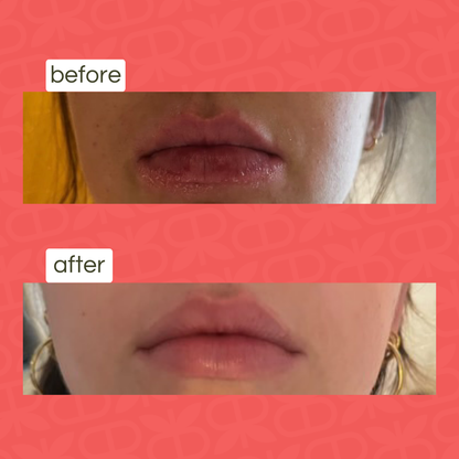 lip balm